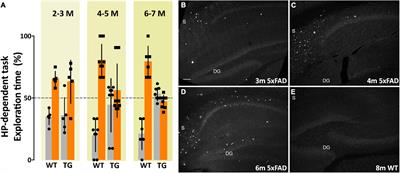 The Therapeutic and Diagnostic Potential of Amyloid β Oligomers Selective Antibodies to Treat Alzheimer’s Disease